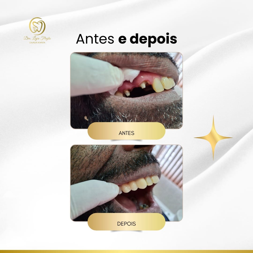 Resultado 5